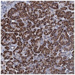 OLAH Rabbit anti-Human, Polyclonal Antibody, Abnova 100 &mu;L | Buy Online | Abnova Corporation | Fisher Scientific