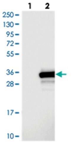 OLAH Rabbit anti-Human, Polyclonal Antibody, Abnova 100 &mu;L | Buy Online | Abnova Corporation | Fisher Scientific