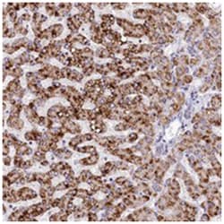 SPINK9, Rabbit, Polyclonal Antibody, Abnova 100&mu;L; Unlabeled:Antibodies,