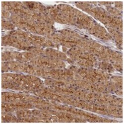 MADD Rabbit anti-Human, Polyclonal Antibody, Abnova 100 &mu;L | Buy Online | Abnova Corporation | Fisher Scientific