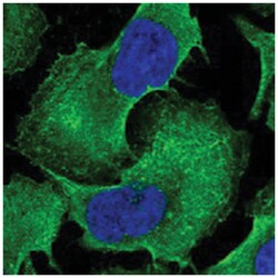 MADD Rabbit anti-Human, Polyclonal Antibody, Abnova 100 &mu;L | Buy Online | Abnova Corporation | Fisher Scientific
