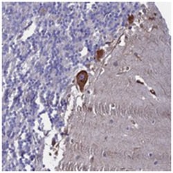 C11orf70, Rabbit, Polyclonal Antibody, Abnova 100 &mu;L | Buy Online | Abnova Corporation | Fisher Scientific