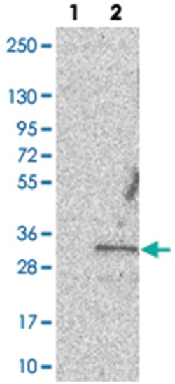 C11orf70, Rabbit, Polyclonal Antibody, Abnova 100 &mu;L | Buy Online | Abnova Corporation | Fisher Scientific