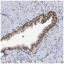 DDX23, Rabbit, Polyclonal Antibody, Abnova 100 &mu;L | Buy Online | Abnova Corporation | Fisher Scientific