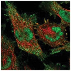 DDX23, Rabbit, Polyclonal Antibody, Abnova 100 &mu;L | Buy Online | Abnova Corporation | Fisher Scientific