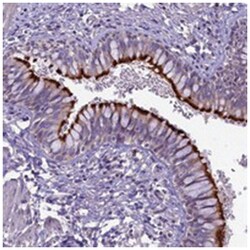 CD99L2 Rabbit anti-Human, Polyclonal Antibody, Abnova 100 &mu;L | Buy Online | Abnova | Fisher Scientific