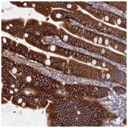 C12orf73, Rabbit, Polyclonal Antibody, Abnova 100 &mu;L | Buy Online | Abnova Corporation | Fisher Scientific