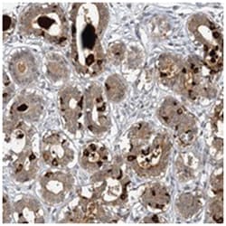 MUCL1, Rabbit, Polyclonal Antibody, Abnova 100 &mu;L | Buy Online | Abnova Corporation | Fisher Scientific