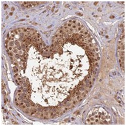 RSPH3 Rabbit anti-Human, Polyclonal Antibody, Abnova 100&mu;L; Unlabeled:Antibodies,