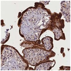 CACNA1H, Rabbit, Polyclonal Antibody, Abnova 100&mu;L; Unlabeled:Antibodies,