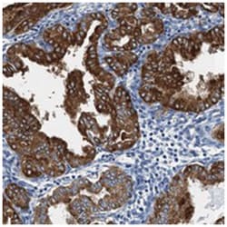 GADL1 Rabbit anti-Human, Polyclonal Antibody, Abnova 100 &mu;L | Buy Online | Abnova Corporation | Fisher Scientific