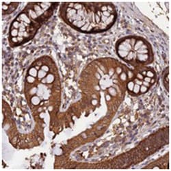 MARK4 Rabbit anti-Human, Polyclonal Antibody, Abnova 100&mu;L; Unlabeled:Antibodies,