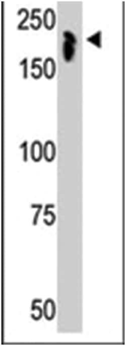 NCOR1, Rabbit, Polyclonal Antibody, Abnova 400&mu;L; Unlabeled:Antibodies,