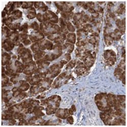 C1orf49, Rabbit, Polyclonal Antibody, Abnova 100 &mu;L | Buy Online | Abnova Corporation | Fisher Scientific
