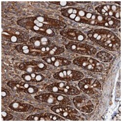 USP6NL, Rabbit, Polyclonal Antibody, Abnova 100&mu;L; Unlabeled:Antibodies,