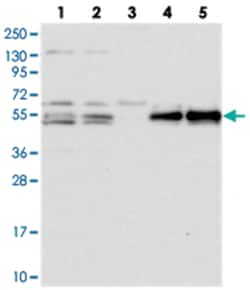 PRRC1, Rabbit, Polyclonal Antibody, Abnova 100 &mu;L | Buy Online | Abnova Corporation | Fisher Scientific