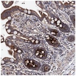 PPTC7 Rabbit anti-Human, Polyclonal Antibody, Abnova 100&mu;L; Unlabeled:Antibodies,
