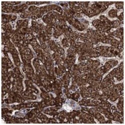 ATHL1, Rabbit, Polyclonal Antibody, Abnova 100 &mu;L | Buy Online | Abnova Corporation | Fisher Scientific