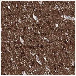 FAM123A, Rabbit, Polyclonal Antibody, Abnova 100 &mu;L | Buy Online | Abnova Corporation | Fisher Scientific