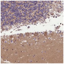 AP3B2 Rabbit anti-Human, Polyclonal Antibody, Abnova 100&mu;L; Unlabeled:Antibodies,