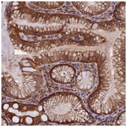 EHBP1L1, Rabbit, Polyclonal Antibody, Abnova 100 &mu;L | Buy Online | Abnova Corporation | Fisher Scientific