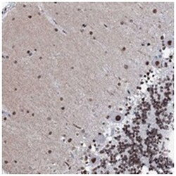 C11orf57 Rabbit anti-Human, Polyclonal Antibody, Abnova 100&mu;L; Unlabeled:Antibodies,