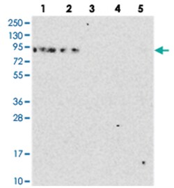 DDX51 Rabbit anti-Human, Polyclonal Antibody, Abnova 100&mu;L; Unlabeled:Antibodies,