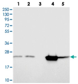 KCNG1 Rabbit anti-Human, Mouse, Rat, Polyclonal Antibody, Abnova 100&mu;L;