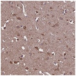 KCNG1 Rabbit anti-Human, Mouse, Rat, Polyclonal Antibody, Abnova 100&mu;L;