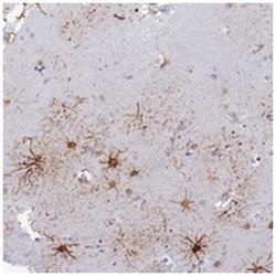 ASUN, Rabbit, Polyclonal Antibody, Abnova 100 &mu;L | Buy Online | Abnova Corporation | Fisher Scientific