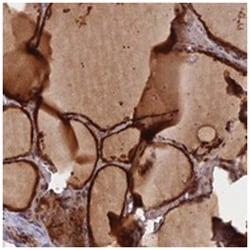 GMCL1, Rabbit, Polyclonal Antibody, Abnova 100&mu;L; Unlabeled:Antibodies,