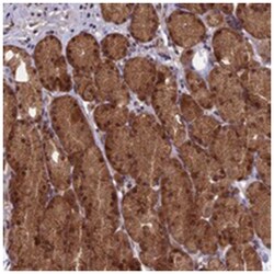 RCCD1 Rabbit anti-Human, Polyclonal Antibody, Abnova 100 &mu;L | Buy Online | Abnova Corporation | Fisher Scientific