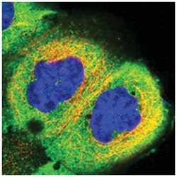 RCCD1 Rabbit anti-Human, Polyclonal Antibody, Abnova 100 &mu;L | Buy Online | Abnova Corporation | Fisher Scientific