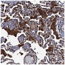 DNHD1, Rabbit, Polyclonal Antibody, Abnova 100 &mu;L | Buy Online | Abnova Corporation | Fisher Scientific