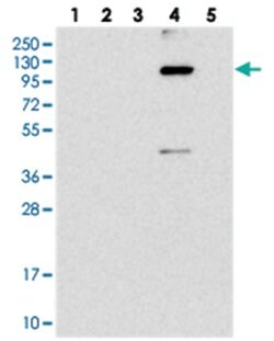 KIAA1468 Rabbit anti-Human, Polyclonal Antibody, Abnova 100 &mu;L | Buy Online | Abnova Corporation | Fisher Scientific