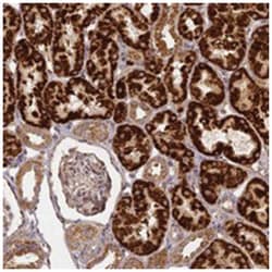 KRT78, Rabbit, Polyclonal Antibody, Abnova 100 &mu;L | Buy Online | Abnova Corporation | Fisher Scientific