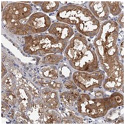 TPCN1, Rabbit, Polyclonal Antibody, Abnova 100 &mu;L | Buy Online | Abnova Corporation | Fisher Scientific