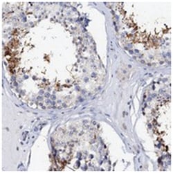 AKAP3, Rabbit, Polyclonal Antibody, Abnova 100 &mu;L | Buy Online | Abnova Corporation | Fisher Scientific