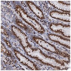 THAP2, Rabbit, Polyclonal Antibody, Abnova 100 &mu;L | Buy Online | Abnova Corporation | Fisher Scientific