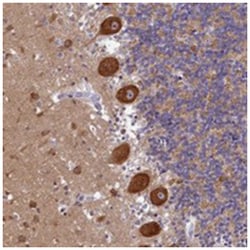 AP3B2 Rabbit anti-Human, Polyclonal Antibody, Abnova 100 &mu;L | Buy Online | Abnova Corporation | Fisher Scientific