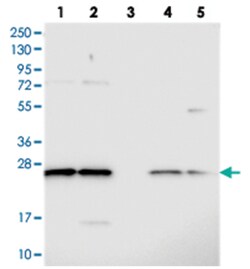 C14orf166, Rabbit, Polyclonal Antibody, Abnova 100&mu;L; Unlabeled:Antibodies,