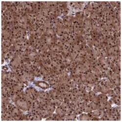 C14orf166, Rabbit, Polyclonal Antibody, Abnova 100&mu;L; Unlabeled:Antibodies,