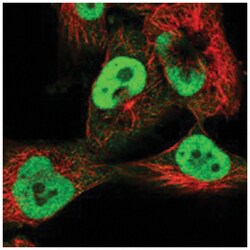 C14orf166, Rabbit, Polyclonal Antibody, Abnova 100&mu;L; Unlabeled:Antibodies,