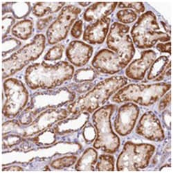 BCO2 Rabbit anti-Human, Polyclonal Antibody, Abnova 100&mu;L; Unlabeled:Antibodies,