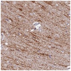 NEDD4 Rabbit anti-Human, Polyclonal Antibody, Abnova 100 &mu;L | Buy Online | Abnova Corporation | Fisher Scientific