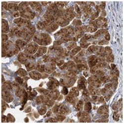 C11orf57 Rabbit anti-Human, Polyclonal Antibody, Abnova 100&mu;L; Unlabeled:Antibodies,