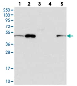 ZDHHC16, Rabbit, Polyclonal Antibody, Abnova 100 &mu;L | Buy Online | Abnova Corporation | Fisher Scientific