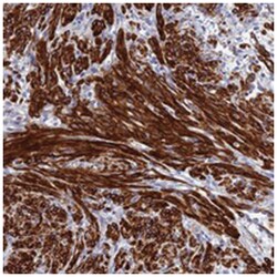 ZDHHC16, Rabbit, Polyclonal Antibody, Abnova 100 &mu;L | Buy Online | Abnova Corporation | Fisher Scientific