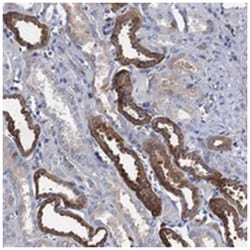 TMEM72, Rabbit, Polyclonal Antibody, Abnova 100 &mu;L | Buy Online | Abnova Corporation | Fisher Scientific
