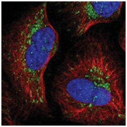 NDUFA12, Rabbit, Polyclonal Antibody, Abnova 100&mu;L; Unlabeled:Antibodies,
